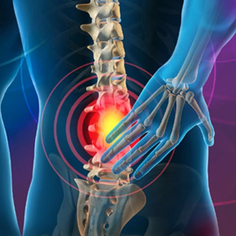 Pain in the Lower Back and Legs
