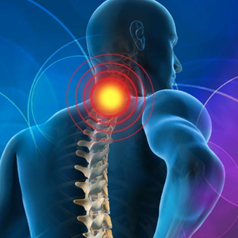 Pain in Arms and Neck
