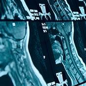 MRI Review