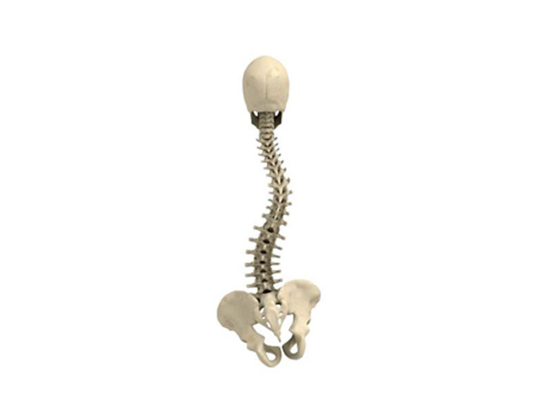 Scoliosis Pain