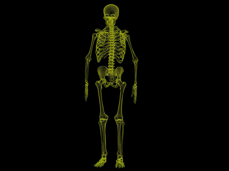 An X-ray for back pain