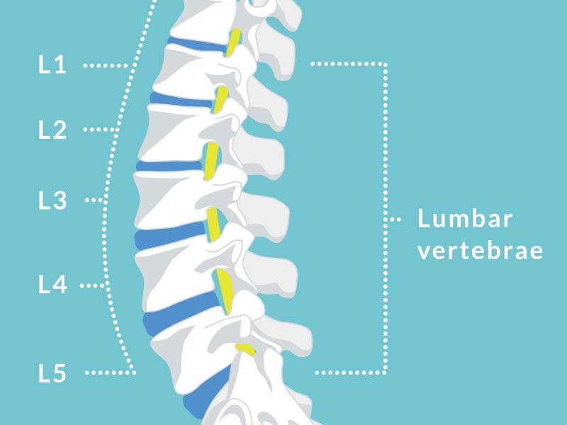 L4-L5 Slipped Disc Diagram