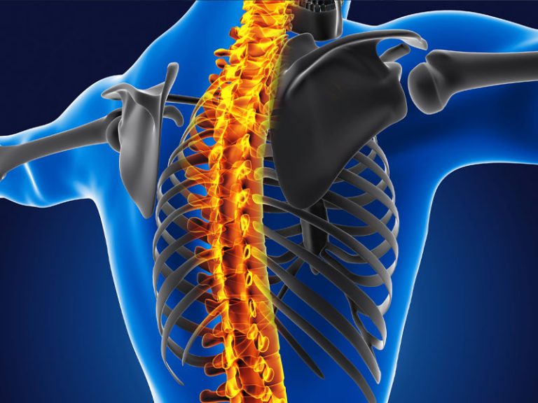 Understanding Scoliosis and Degenerative Disc Disease: Causes, Symptoms, and Treatment Options
