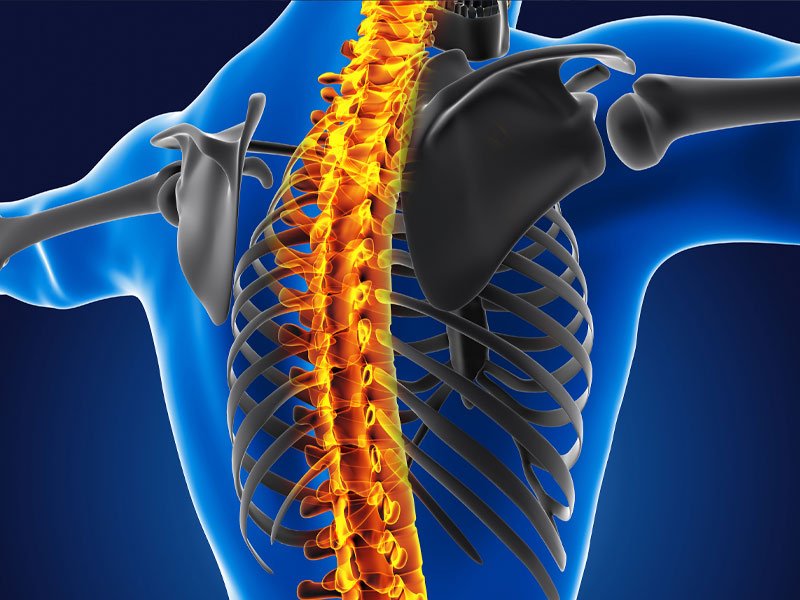 Understanding Scoliosis and Degenerative Disc Disease: Causes, Symptoms, and Treatment Options
