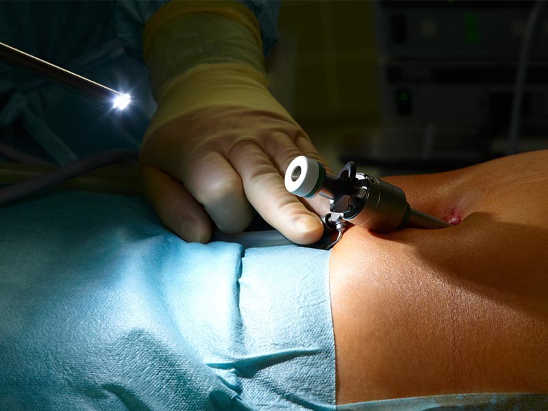 Minimally Invasive Spine Surgery
