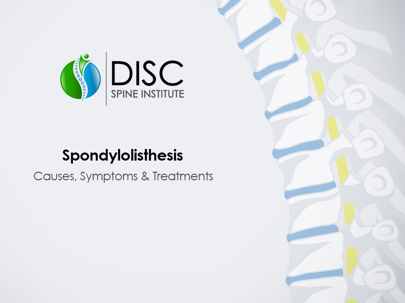 Spondylolisthesis