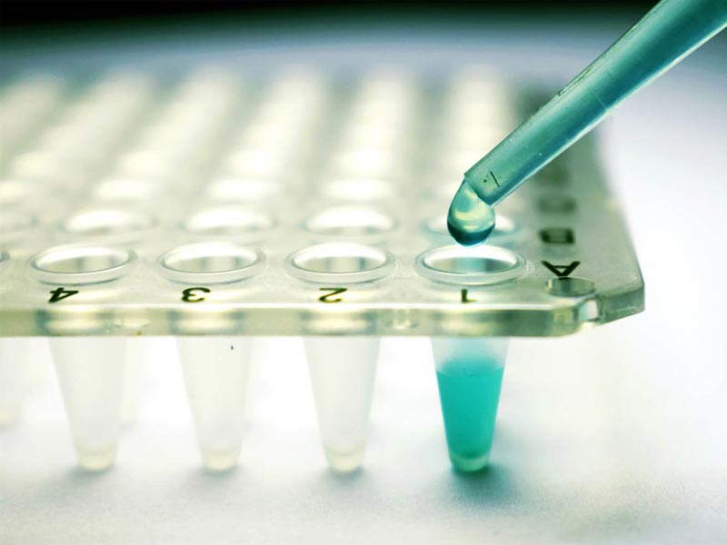 Stem Cell Treatment for a Degenerative Disc