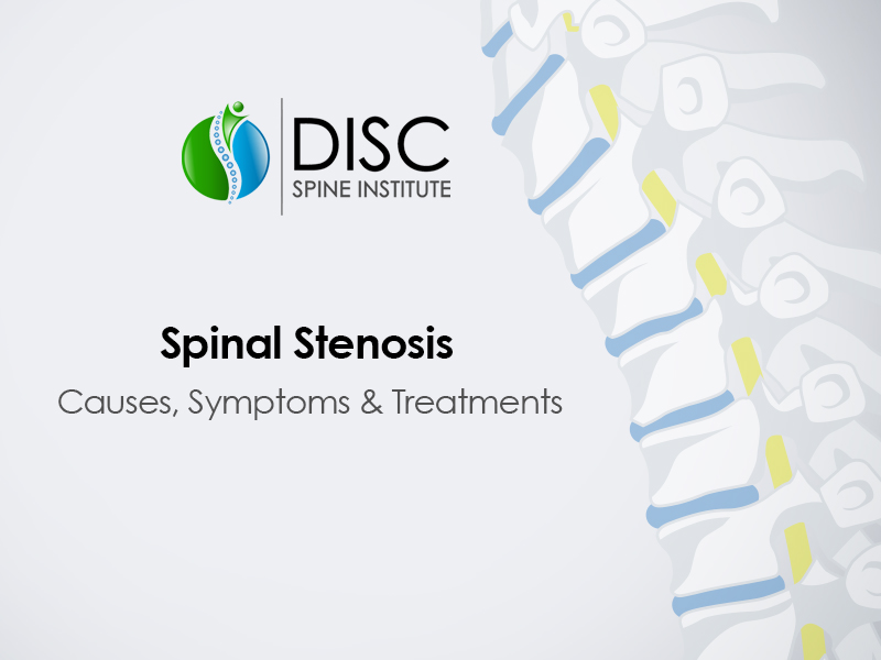 Spinal Stenosis Video